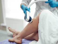 Electrolisis Mengakibatkan Iritasi Kulit